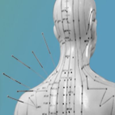 Imagen de Holistic Palma mostrando algunos de los puntos importantes en acupuntura